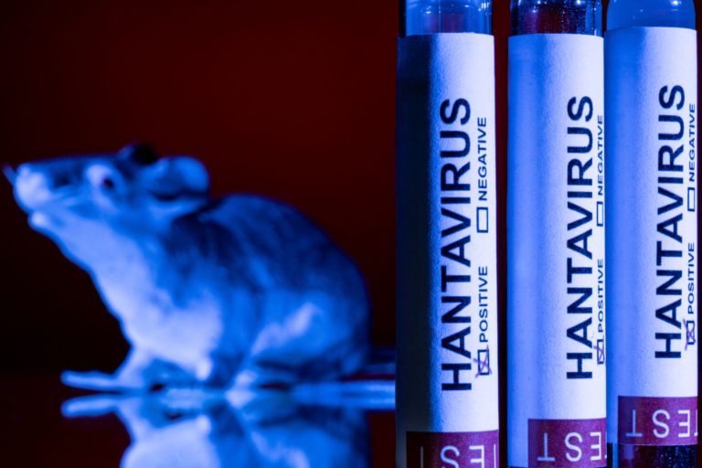 Hantavirus Case Confirmed