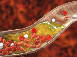 Increase HDL Naturally
